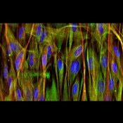 Immunofluorescence image of human dental pulp stem cells labeled with DSHB antibody 3CB2 against Vimentin (green). PMID: 29370163, Fig. 5D.